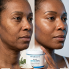 JELLYMASK LIFTANT | Acide hyaluronique