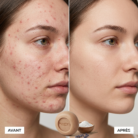 SAVON/MASQUE ANTI-IMPERFECTION | Lait d’ânesse bio, curcuma, tea tree, huile d’argan